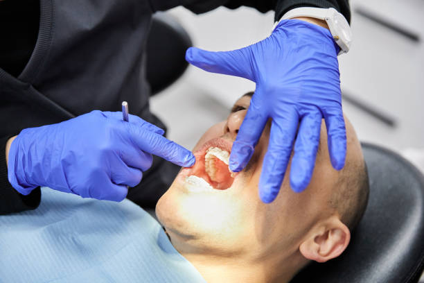 Best Cracked Tooth Emergency Dentist  in Craig Beach, OH