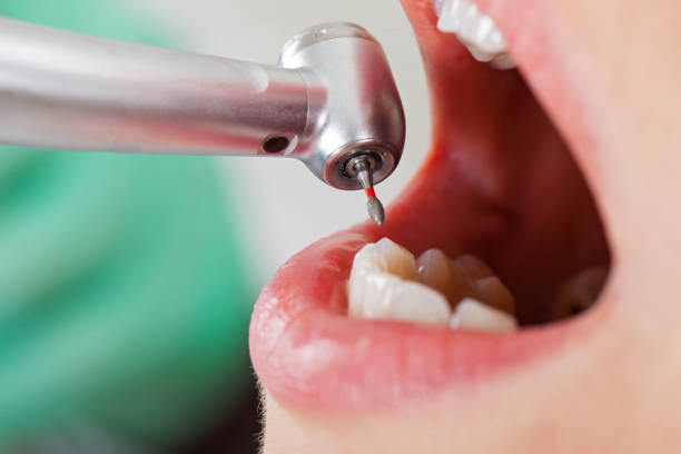 Best Tooth Pain Emergency Relief  in Craig Beach, OH